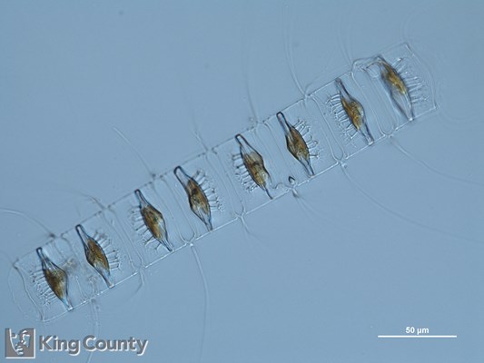 Photo of Chaetoceros diadema